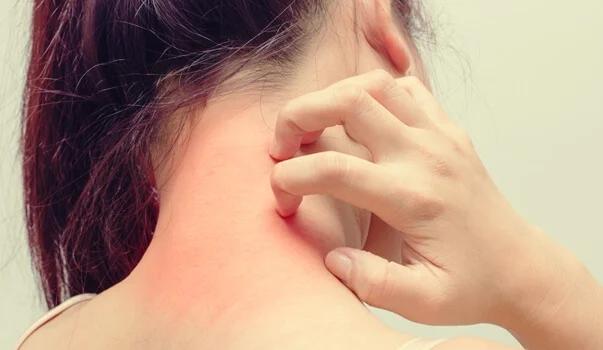 dermatitis causas psicologicas - Cómo saber si la dermatitis es por estrés