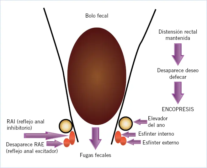 retencion de heces en niños psicologia - Qué causa la retencion de heces