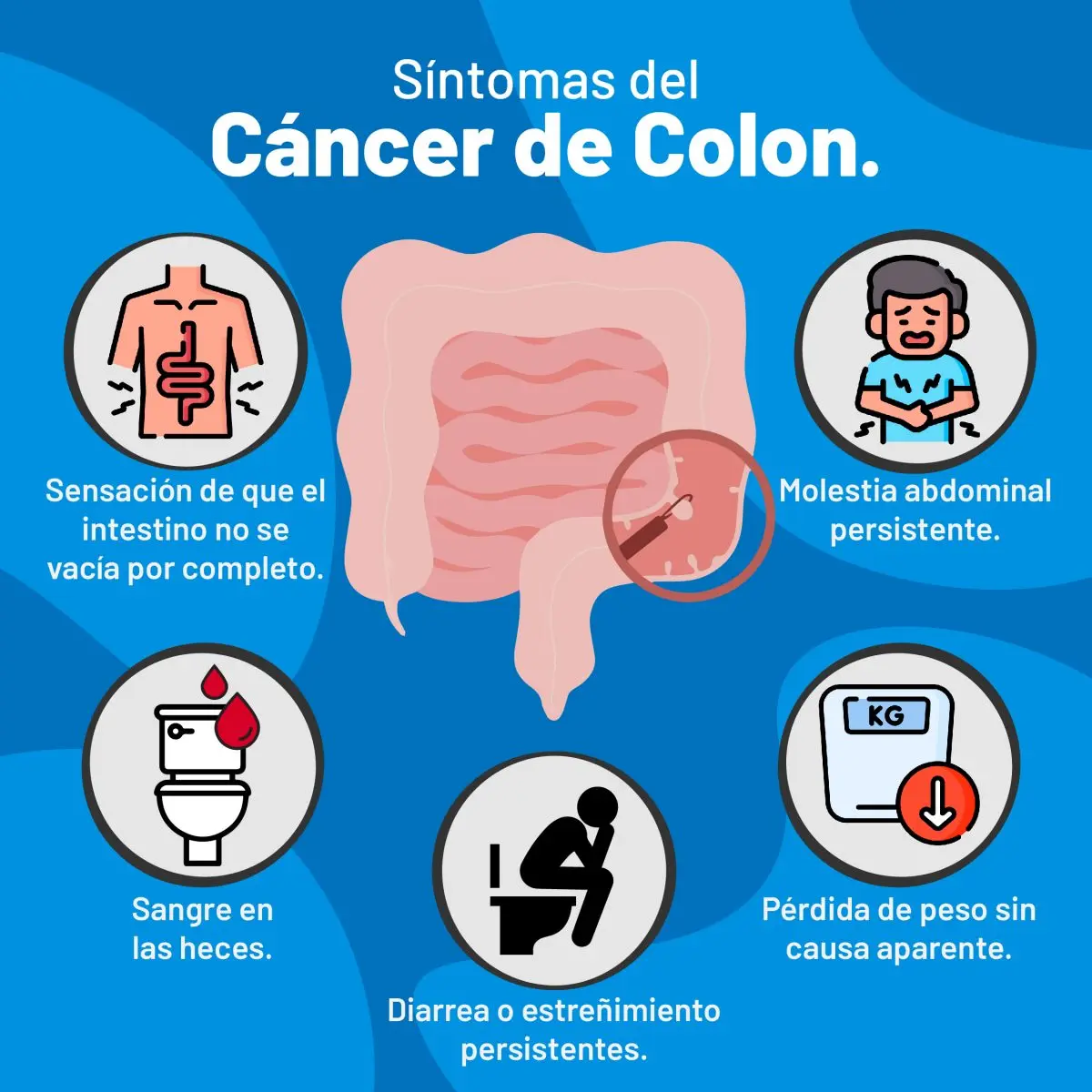 cancer de colon causas psicologicas - Qué motivos te pueden provocar un cáncer de colon